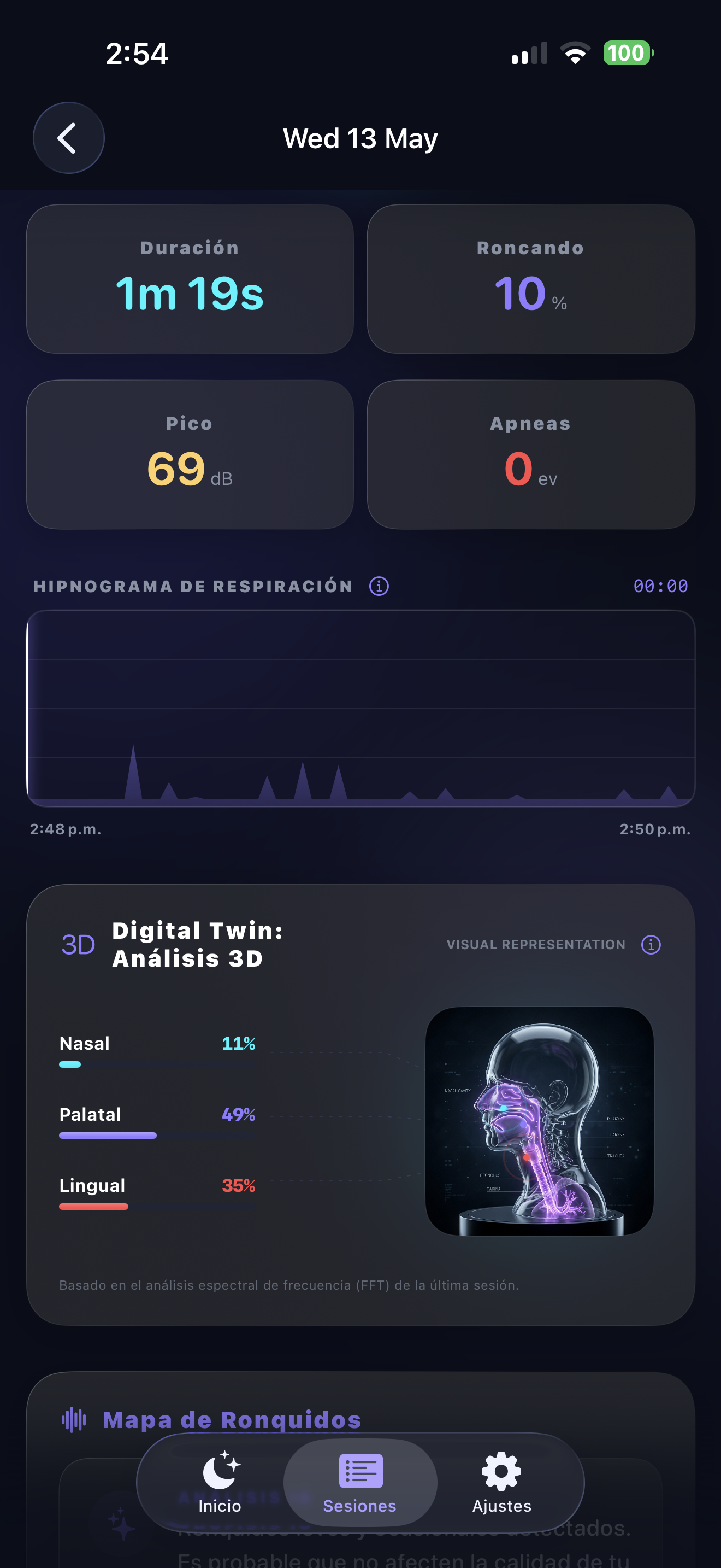 Detalle de una sesión nocturna y análisis acústico